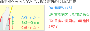 歯周ポケットの深さによる歯周病の状態の目安