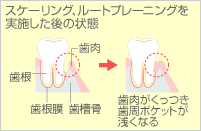 再評価