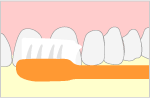 ブラッシング指導