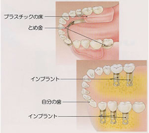 従来の方法との違い