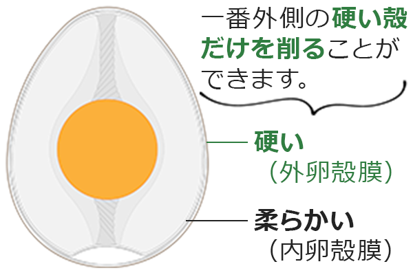 ピエゾサージェリーのイメージ画像