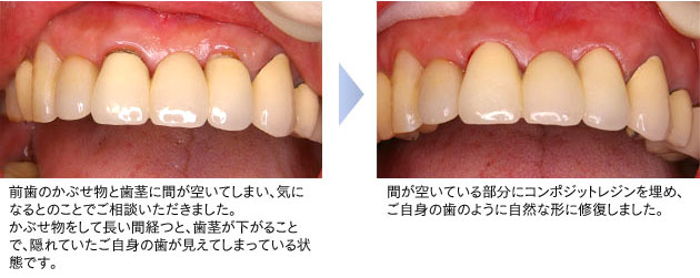 症例紹介（保険診療）