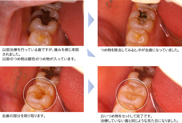 症例紹介（自費診療）